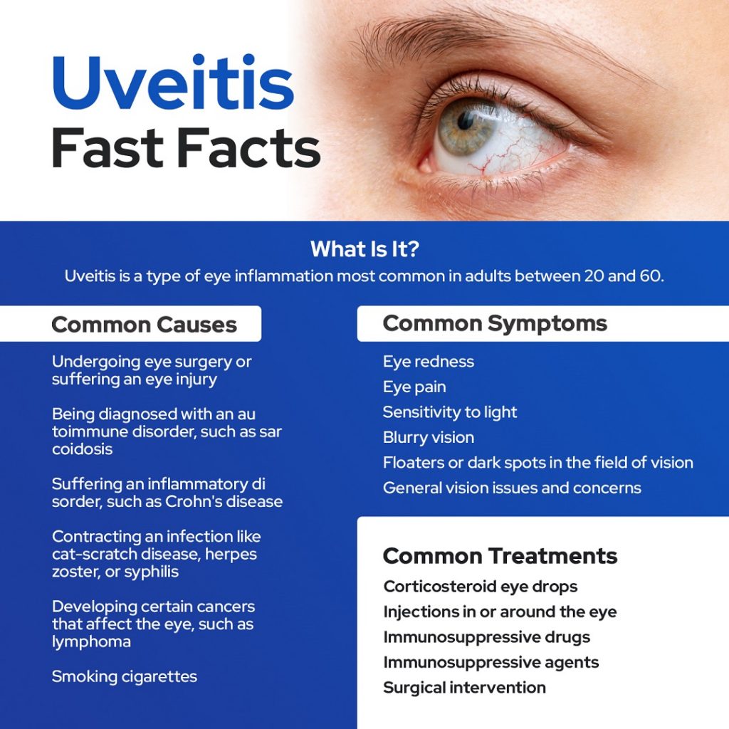 Uveitis Causes Symptoms Treatments Facts