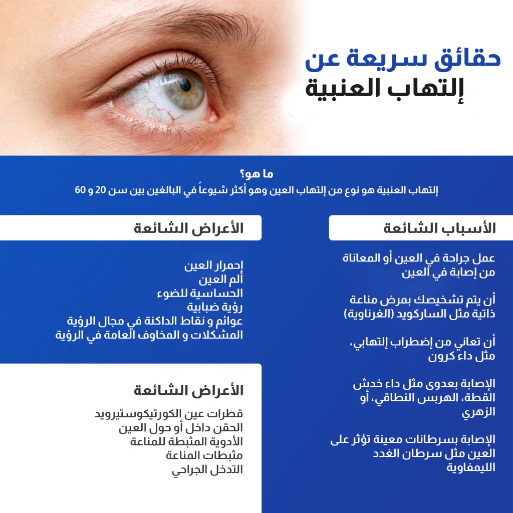 UVEITIS Treatment